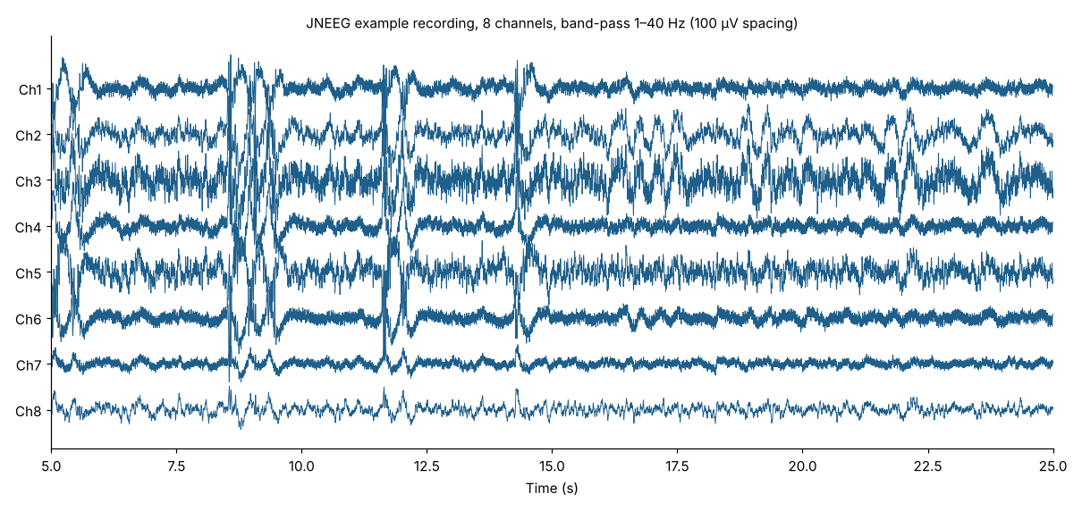 JNEEG example recording: 8 channels, band-pass 1–40 Hz