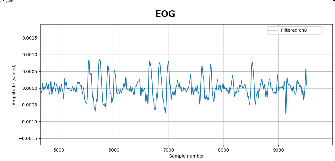 Blinking (EOG) recorded with MicroBCI
