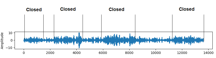 Alpha rhythm appears when the eyes are closed