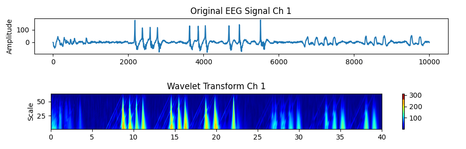 Chewing and blinking artifacts in PiEEG-8 EEG with wavelet transform