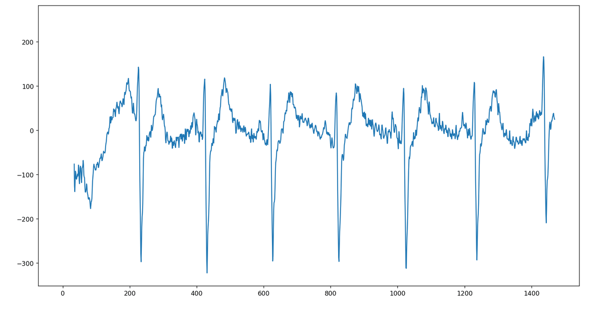 ECG recorded with PiEEG-8